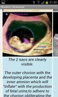 Obstetric Ultrasound-Lite