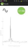 Lift Pulse