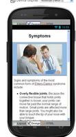 Ehlers Danlos Syndrome Disease
