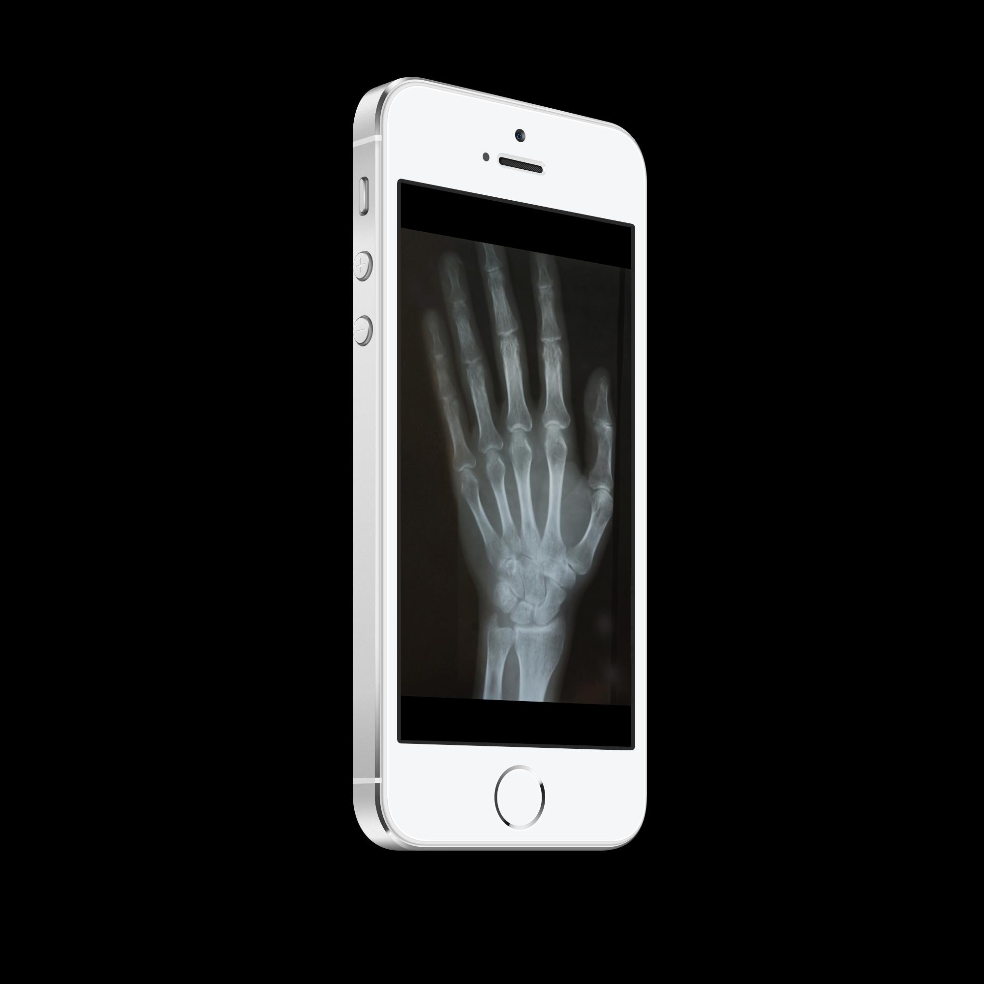 Xray Scanner