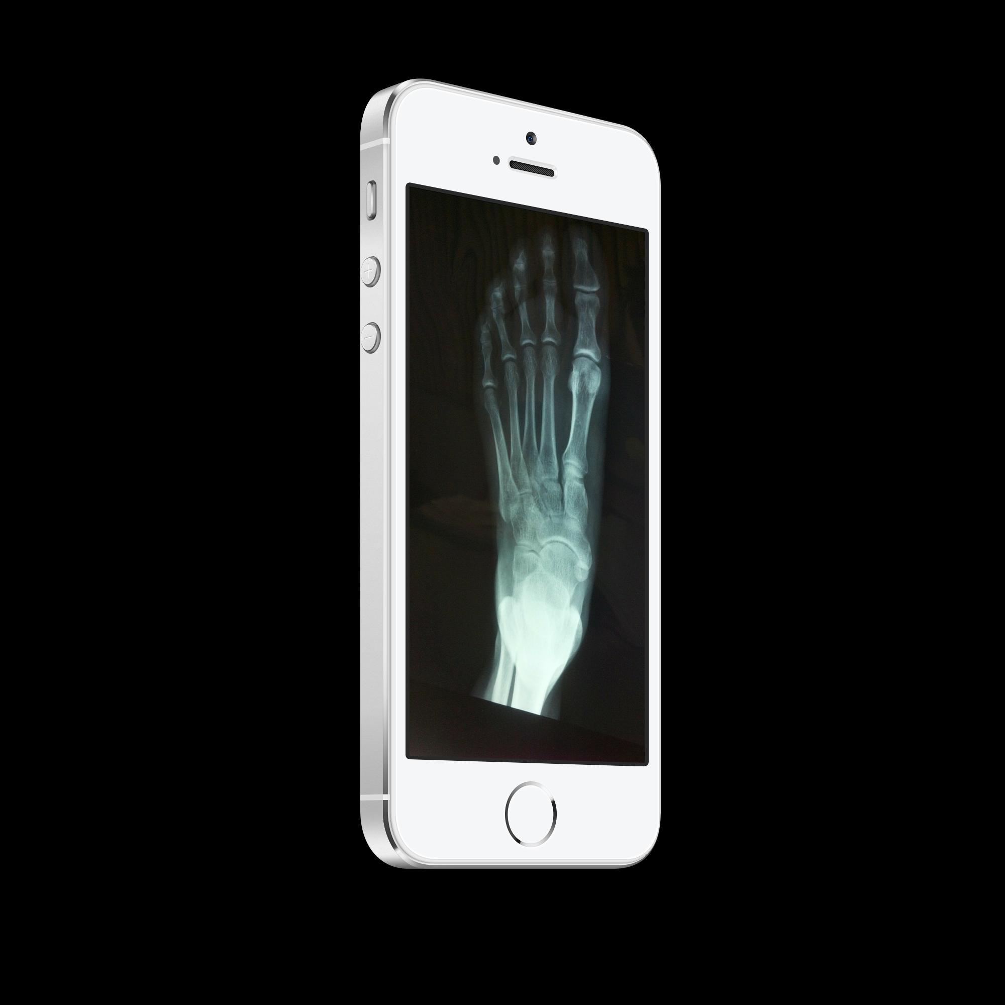 Xray Scanner