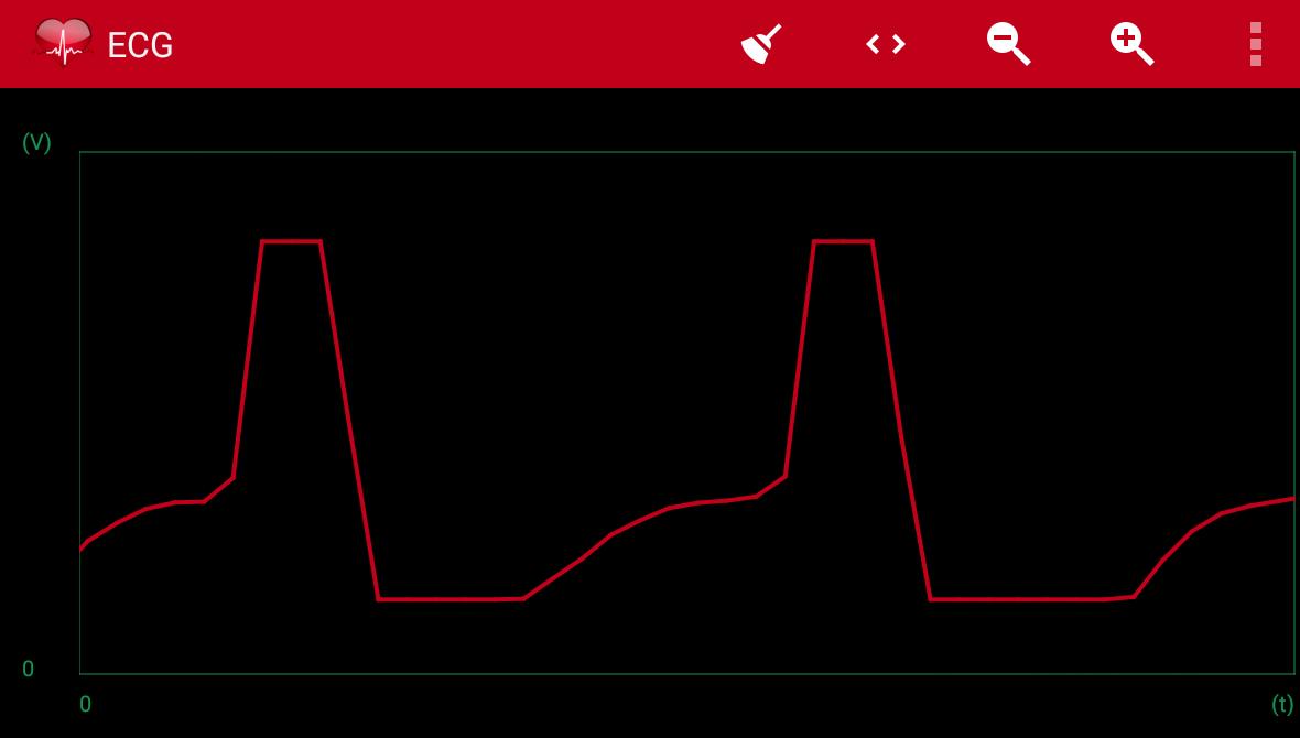 Arduino ECG