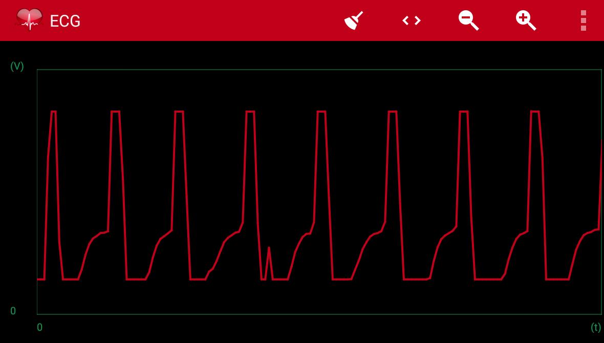 Arduino ECG