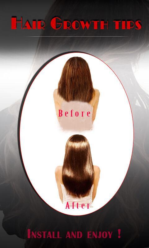 Hair Growth in 30 Days