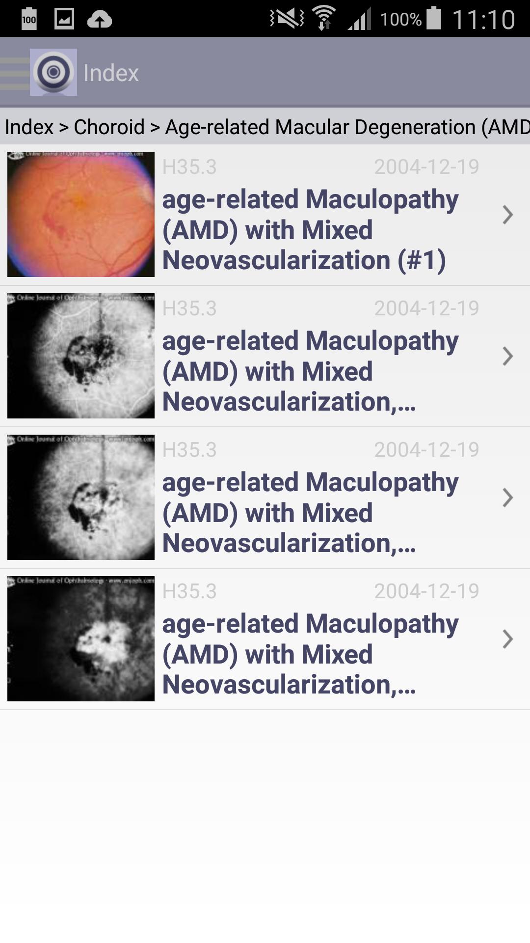 Atlas of Ophthalmology Onjoph