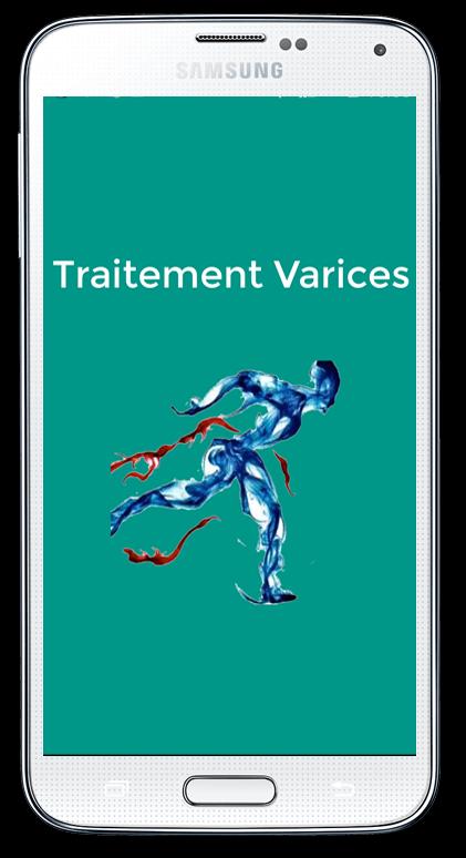 Traitement Varices Casablanca