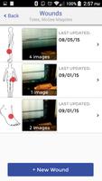 Mobile Wound Care