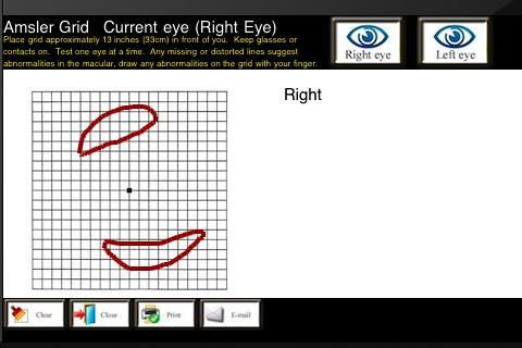 eyeTestsDroid